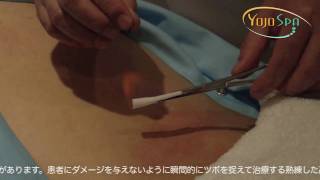 火鍼 - 究極の鍼治療 - YOJOSPA