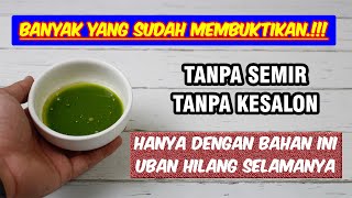 JANGAN DISEMIR... OLESKAN INI MAKA UBAN DI KEPALAMU AKAN LENYAP PERMANEN