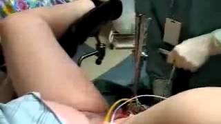 helpmed.moy.su   роды с помощью акушерских щипцов