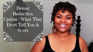 Breast Reduction Update| What They Dont Tell You & Scars