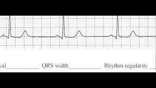 Chapter 1-2 Sinus Rhythms Strip 1 (in class practice)