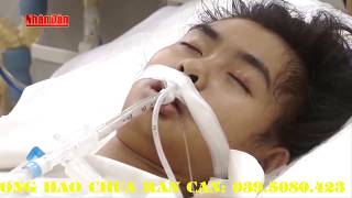 Chữa Rắn độc cắn, chó dại cắn, mèo hoang cắn, bọ cạp đốt, ong đốt, rết cắn...