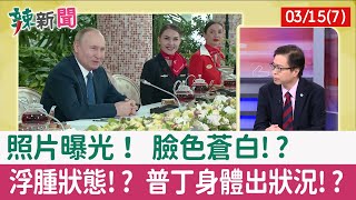 【辣新聞152 重點摘要】照片曝光！ 臉色蒼白!? 浮腫狀態!? 普丁身體出狀況!? 2022.03.15(7)
