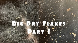 BIG DRY FLAKES | Part 1
