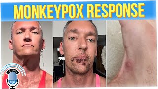 White House Scrambles to Play Catch-up on Monkeypox Response