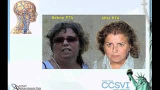 Fabrizio Salvi, MD [Clinical Manifestations of CCSVI | CCSVI Symposium 2011 - 9 of 46]
