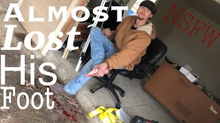 My friend almost lost his foot (NSFW) Heaps of Fun #34