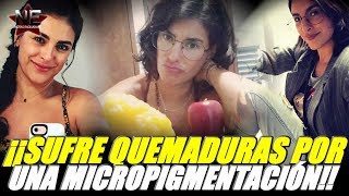 Liz Gallardo padece quemaduras por hacerse una micropigmentación de cejas