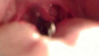 Water Swallowing