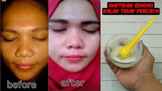 TAK USAH SUNTIK VITAMIN C, RACIKAN INI BISA MEMBUAT WAJAHMU JADI PUTIH KEMBALI DALAM BEBERAPA HARI