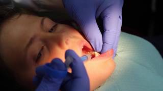 My Technique: How I Use Anutra for Pediatric Patients