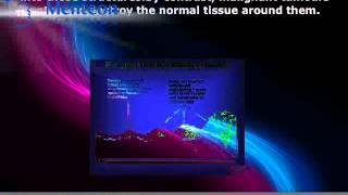 Benign and Malignant Tumors