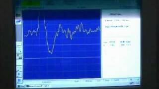 Visuell Evozierte Potentiale (VEP)