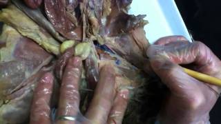204 Human Anatomy - Cat Dissection - Blood Vessels