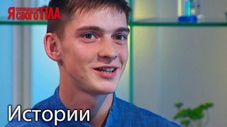 Результаты лечения Ивана Коваля (отсутствие зубов и деформация челюсти)