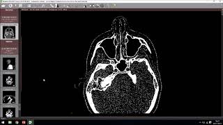 RadiAnt DICOM viewer