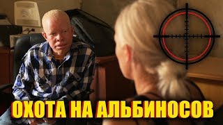 АЛЬБИНОСЫ В АФРИКЕ. ОХОТА НА АЛЬБИНОСОВ | ЛУЧШЕЕ ОТ ОРЛА И РЕШКИ