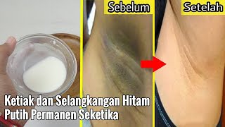 CUMA PAKAI RACIKAN INI, KETIAK DANZELANGKANGAAN HITAM PUTIH KEMBALI SECARA ALAMI