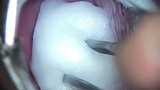 APRO-110