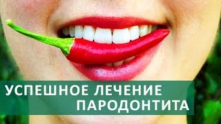 Лечение десен .Пародонтология: Лечение заболеваний десен,удаление зубного камня.ЦЭЛТ