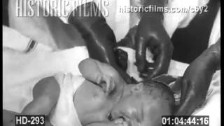 GRAPHIC CHILDBIRTH, 1936