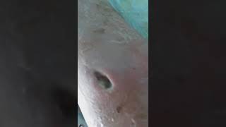 Вот что бывает когда слишком много в жизни наркотиков внутривенно!