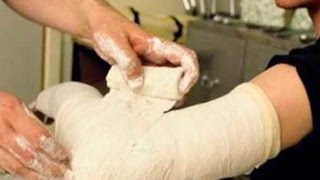 Зуд кожи - при переломах под гипсом полезные советы если чешется рука