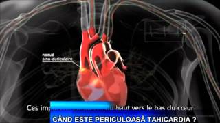 CAND ESTE PERICULOASA TAHICARDIA?