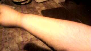forearms