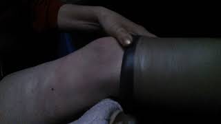 Amputee My SOCKET 2
