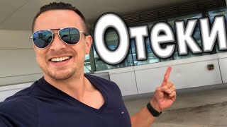 Отеки - как избавиться и предотвратить их появление | Борьба с отечностью