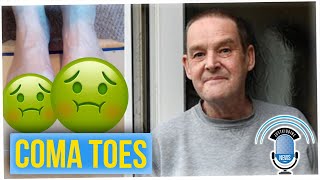 Man's Wife Refused to Sleep in Same Bed Because Toes Kept Falling Off (ft. Dante Basco)