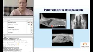 Основы рентгенологии, рентгеноанатомия и рентгенопатологии органов грудной полости