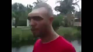 سبحان الله شاهد هذا الرجل بنصف دماغ ولس عايش
