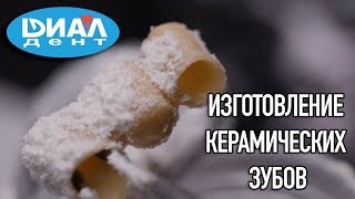 Изготовление керамических зубов.