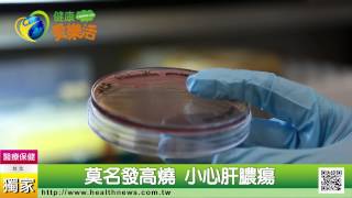 莫名發高燒 小心肝膿瘍