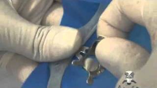 Equipe de Endodontia de Campinas - Isolamento Absoluto (Andressa Salles))