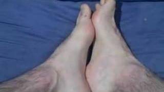Hairy Feet