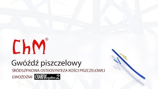 Gwóźdź piszczelowy CHARFIX2