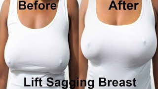 I no longer have saggy boobs.