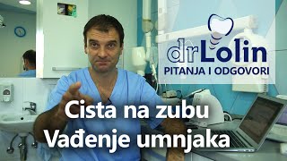 TV Dr Lolin Emisija 2 Pitanja i odgovori Cista na zubu Vadjenje umnjaka