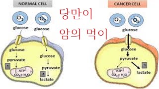 대사치료 암을 굶겨 죽이다 채소 곡식 모든 탄수화물은 당 암의 먹이 glucose cancer metabolism vegetable grain carbohydrate