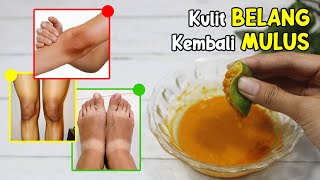 HANYA 5 MENIT, CARA MEMUTIHKAN KULIT SECARA ALAMI, KULIT BELANG LENYAP SELAMANYA [SUDAH TERBUKTI]