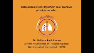 Stent endobronquial (Ultraflex®)
