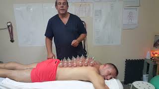 Banki czyli Vacuterapia - dla kogo i po co ?