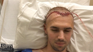 FINALLY GOT A NEW FOREHEAD!
