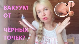 Я ПОРАЖЕНА БОЛЬ И СТРАДАНИЯ?! ВАКУУМНЫЙ ОЧИСТИТЕЛЬ ПОР ИЗ WISH! Бьюти