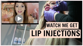 WATCH ME GET LIP INJECTIONS + UNSEEN FOOTAGE FROM BEFORE MY FIRST TIME 3 YEARS AGO!