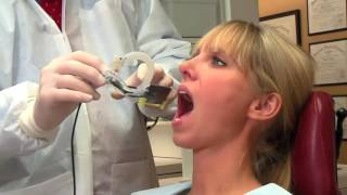TrollByte Kimera HBW - позиционер датчика радиовизиографа | Troll Dental (Швеция)