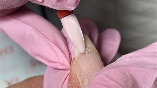 Как починить сломанный ноготь? Гель-лак и файбергласс